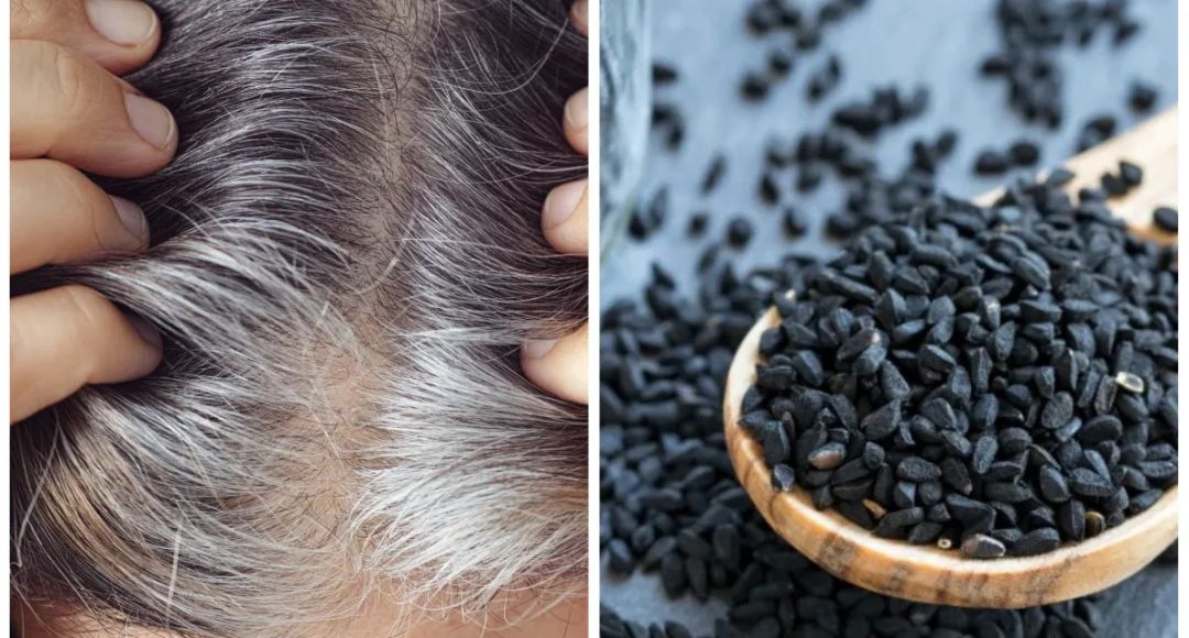 Nigella Seeds For Hair