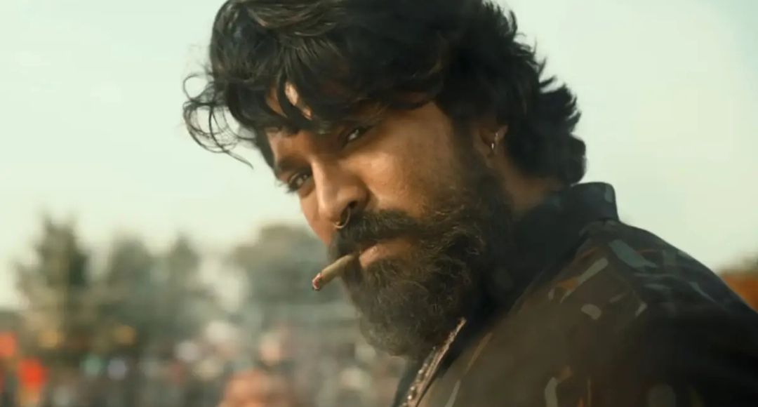 Ram Charan Injury Update