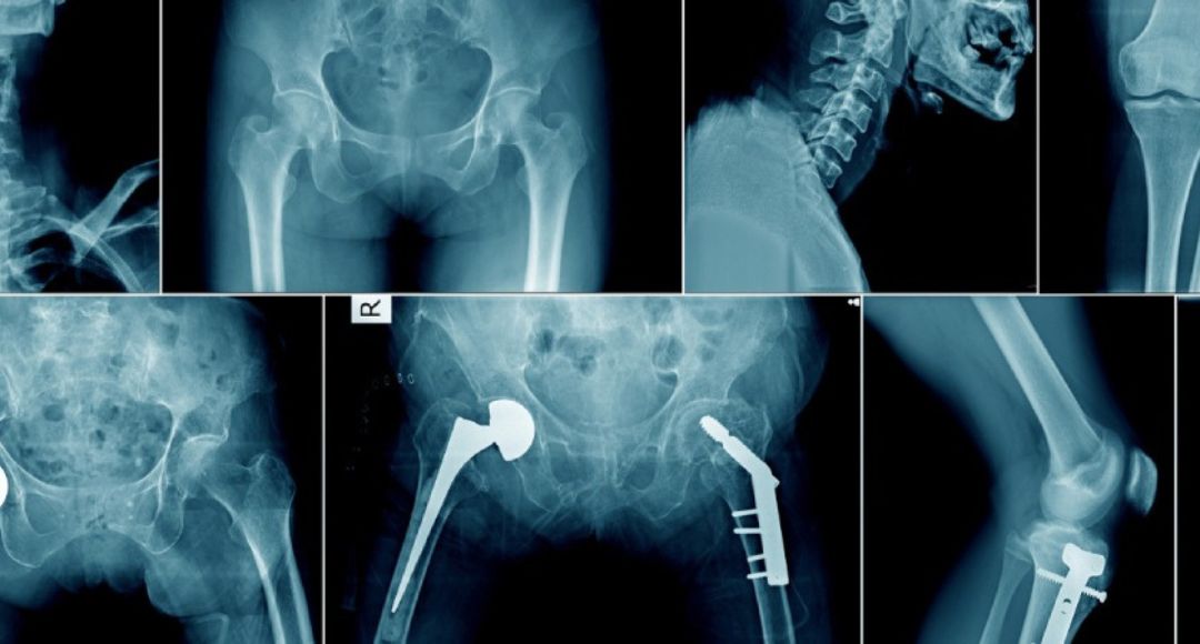 Bihar X-Ray Technician Document Verification