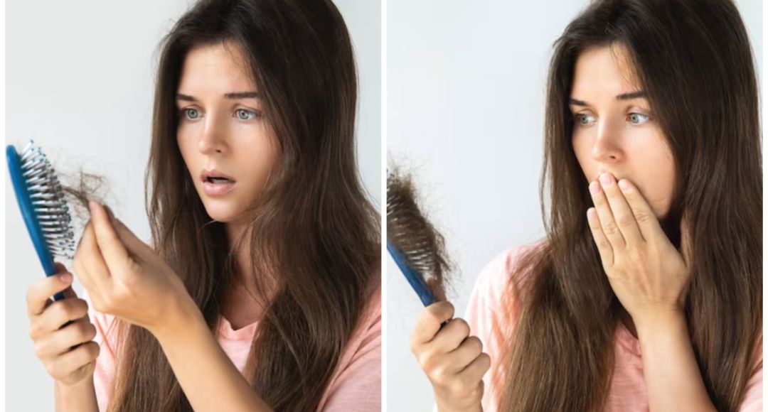 Hair Fall Home Remedies